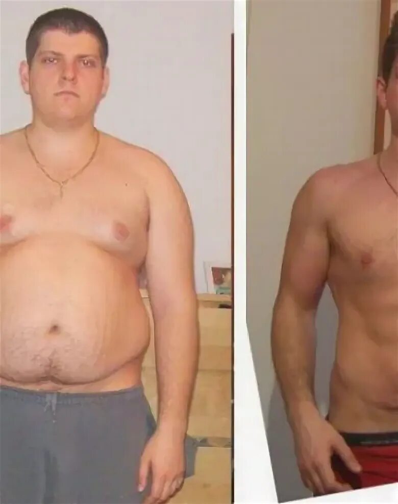 Мужчина после 75. Липосакция живота у мужчин до и после. Липосакция живота у мужчин. Липосакция у мужчин до и после. До и после похудения мужчины.
