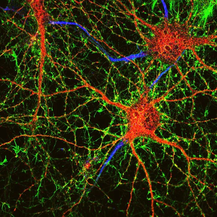 Новые клетки мозга. Структура нейронов мозга. Нейрон клетка головного мозга. Нейронные клетки головного мозга. Флуоресцентная микрофотография нейрона.