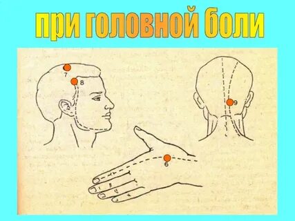 Точки на руках от головной боли