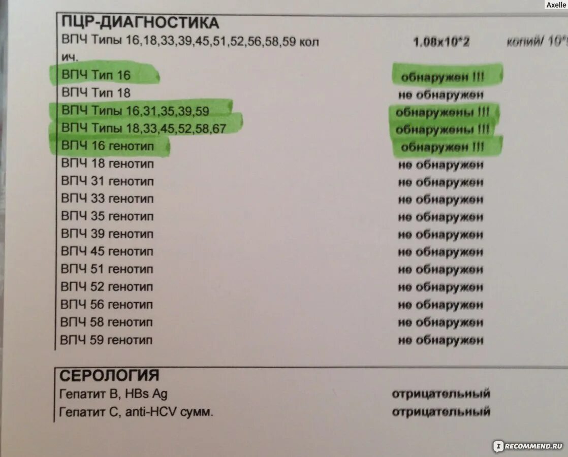 Расшифровка впч анализа у женщин в гинекологии. Исследование на ВПЧ методом ПЦР. Выявление ДНК вируса папилломы человека методом ПЦР. HPV 35 вирус папилломы ПЦР норма. Вирус папилломы человека 21 ПЦР анализ.