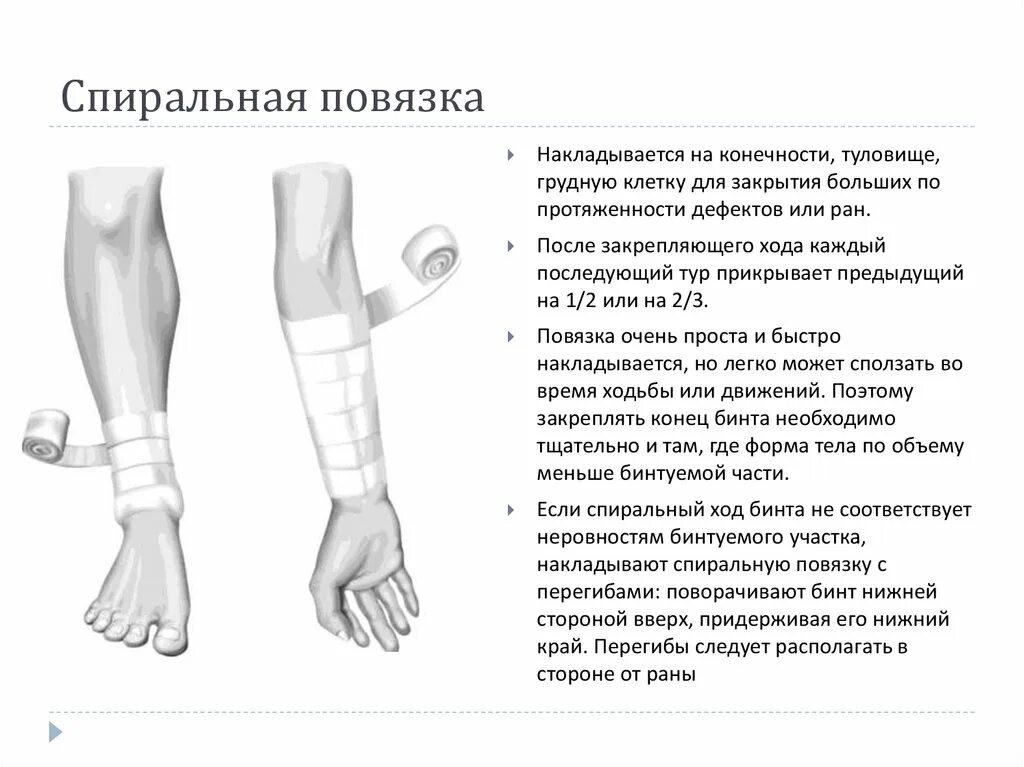 Спиральная повязка техника наложения