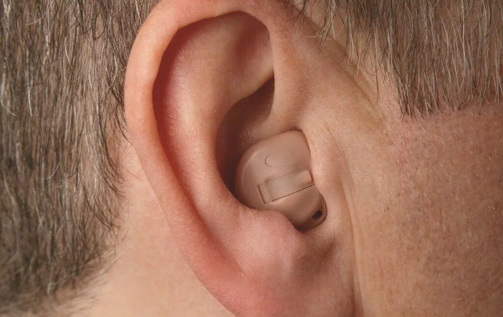 Почему свист в ушах. Слуховой аппарат ITC. Индивидуальные слуховые аппараты. Внутриканальный слуховой аппарат.
