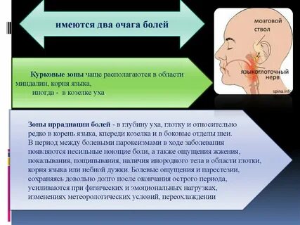 Невралгия языкоглоточного нерва лечение