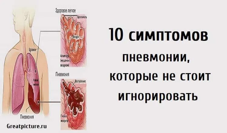 Первые признаки воспаление. Воспаление лёгких симптомы. Признаки воспаления легких.