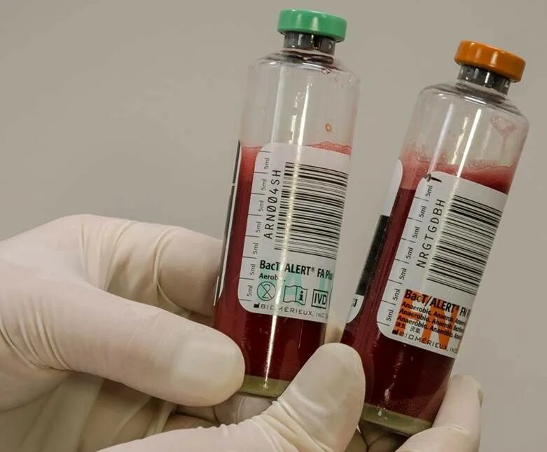 При заборе крови на гемокультуру направление оформляется. Флакон для посева крови на стерильность. Забор крови на стерильность во флакон.