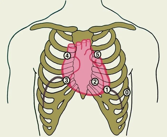 Аускультация сердца межреберье. Точки аускультации грудной клетки. Грудная клетка точки аускультации сердце. Точки аускультации сердца 6 точек. Клапаны сердца на грудной клетке