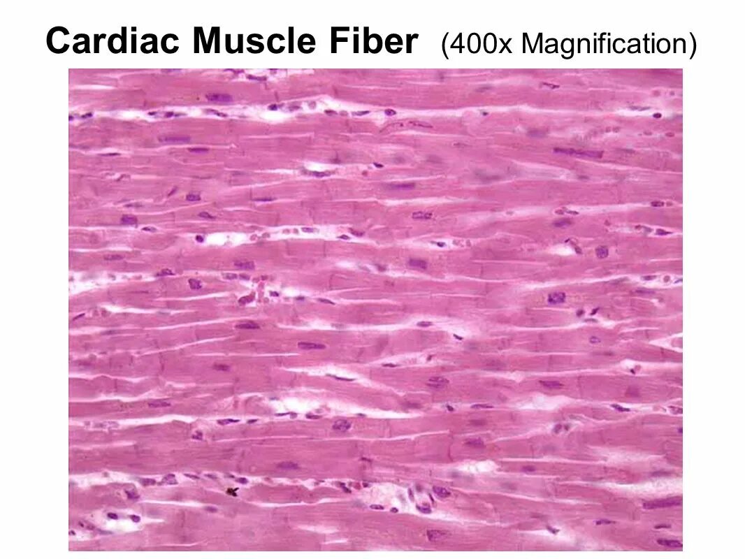 Сердечная ткань миокарда. Поперечнополосатая сердечная мышечная ткань гистология препарат. поперечно полосатая сердечная мышечная ткань гистология препарат. гладкая мышечная ткань гистология. поперечно полосатая сердечная ткань гистология препарат.