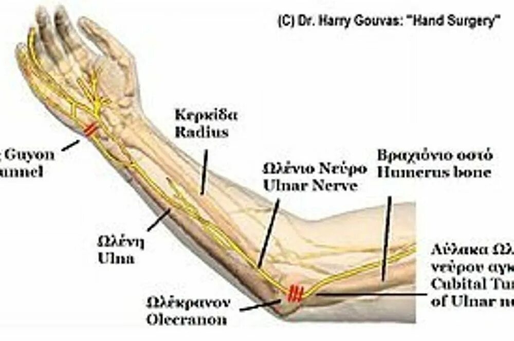 Локтевой сустав анатомия локтевой нерв. Анатомия локтевого нерва в области локтевого сустава. Локтевой нерв в канале Гийона. Строение нервов локтевого сустава. Болят кости после операции