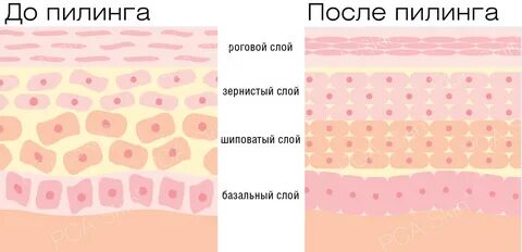 Ороговевший слой кожи