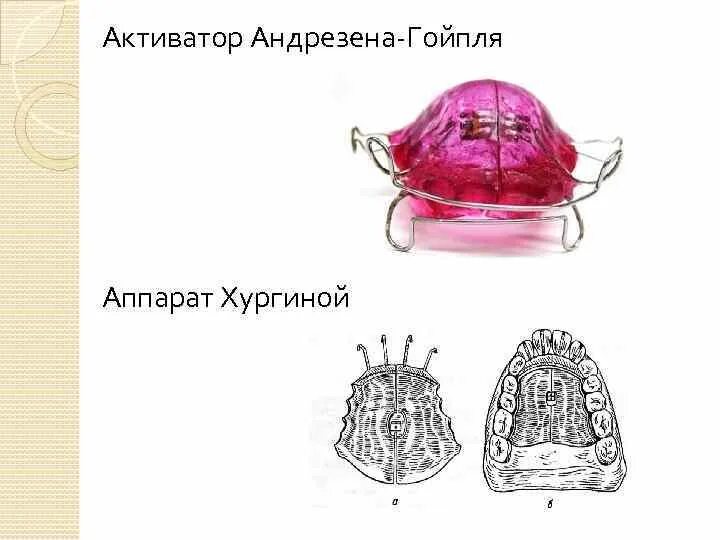 Аппарат (моноблок) Андрезена-Гойпля. Аппарат (активатор) Андрезена-Гойпля. Моноблока активатора Андрезена-Гойпля. Активатор Андрезена. Активатор гойпля