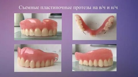 Частично съемные протезы этапы