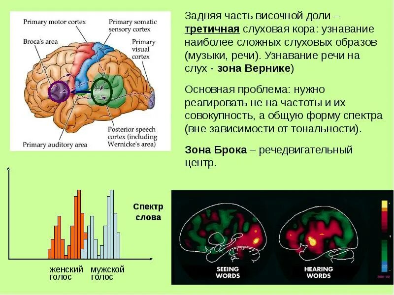 Какая зона в височной доле. Части височной доли.