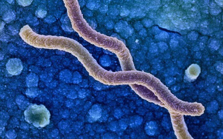 Бактерии хеликобактер причины. Бактерия хеликобактер пилори. Helicobacter pylori микроскопия. Заражение хеликобактер пилори.