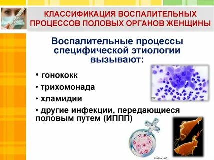 Воспалительные заболевания женских половых органов нижнего отдела
