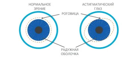 Астигматизм тест нмо с ответами по утвержденным