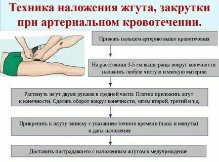 Первая помощь при кровотечении 8 класс