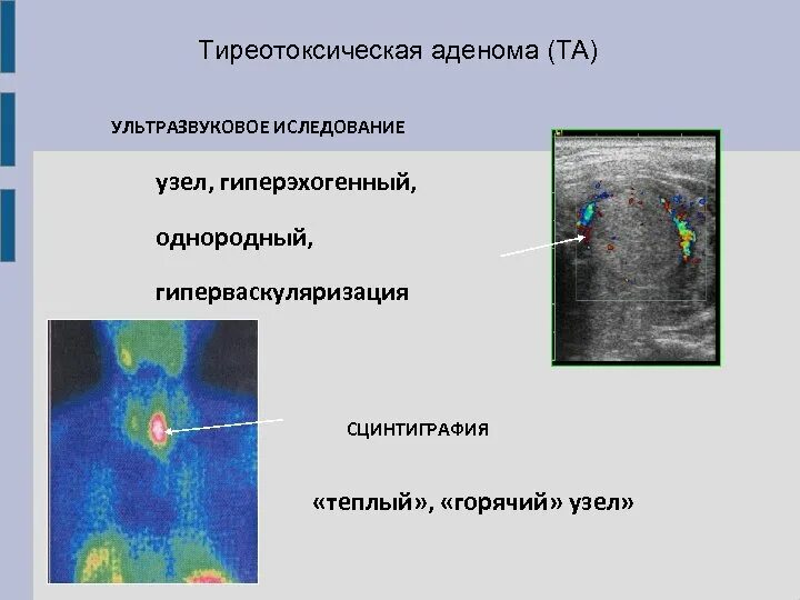 Как часто можно делать сцинтиграфию