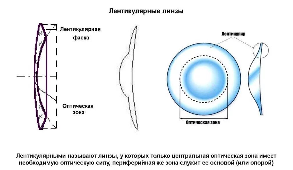 Как выбрать оптические линзы. Схема конструкции мягкой контактной линзы. Цилиндрические и торические линзы схема. Строение мягкой контактной линзы. Мягкие контактные линзы классификация.