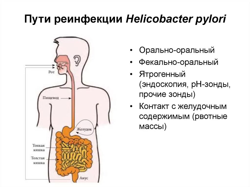 Пути инфицирования хеликобактер пилори. Механизм передачи хеликобактер пилори. Язвенная болезнь желудка Helicobacter. Пути передачи хеликобактер пилори от человека к человеку. Причины появления хеликобактер в желудке