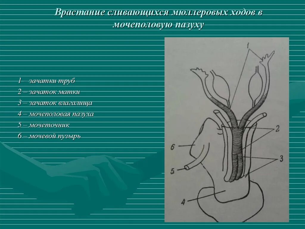 Сильные половые органы. Мочеполовая пазуха. Аномалии развития женских половых органов.