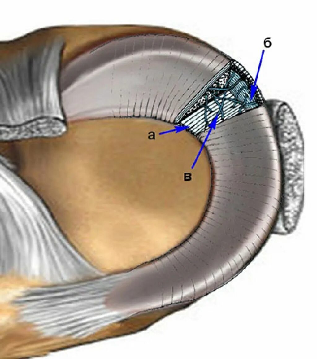 Артроскопическая резекция медиального мениска. Задний Рог мениска коленного сустава. Задний Рог медиального мениска анатомия. Повреждение переднего рога
