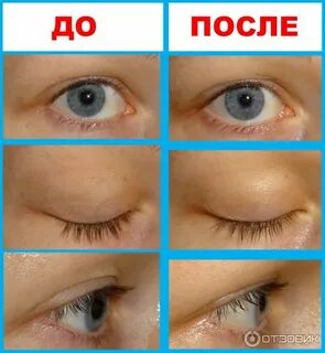 Восстанавливают реснички