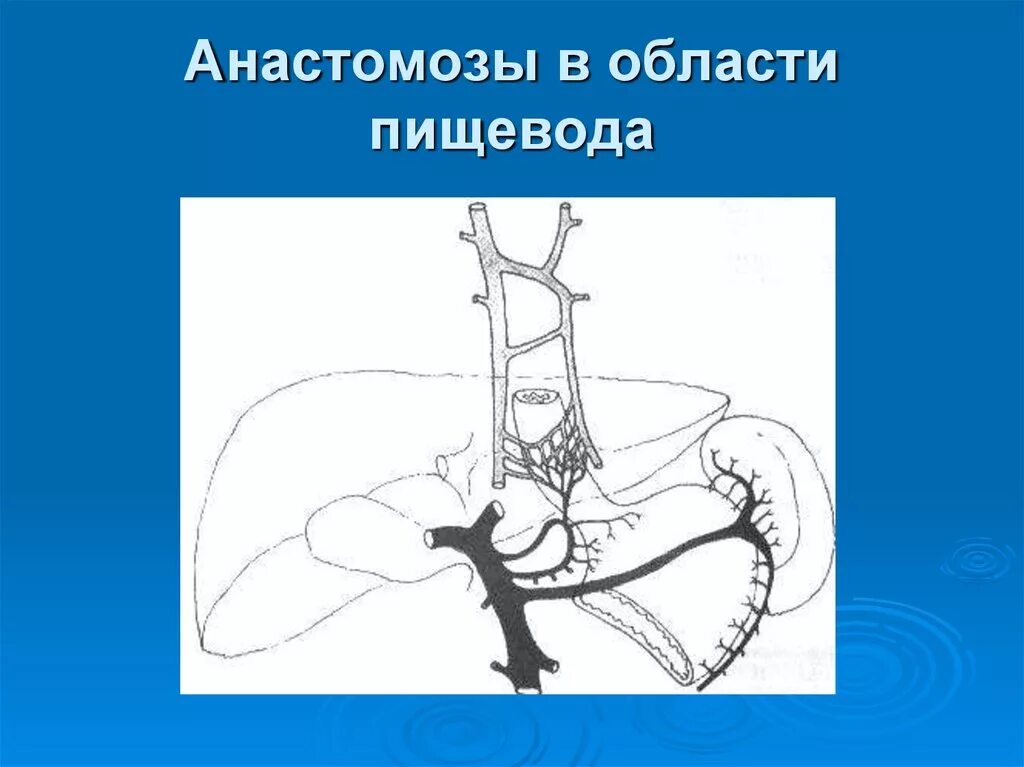 Портокавальные анастомозы пищевода. Пищеводно-желудочный Порто-кавальный анастомоз. Порто кавальные анастомозы желудка. Анастомозы вен портокавальные. Анастомоз пищевода