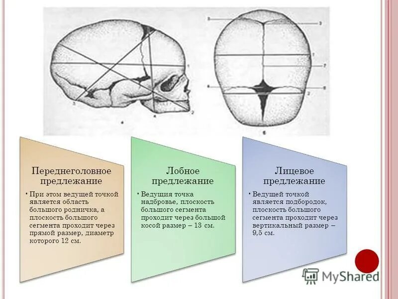 Значение родничков. Сегменты головки плода. Косой размер головки. Малый косой размер большой что это.