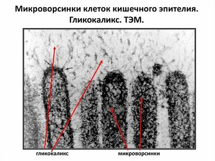 Эпителий с микроворсинками называется