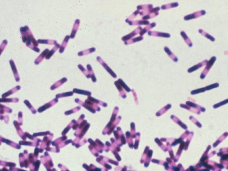 Megasphaera spp