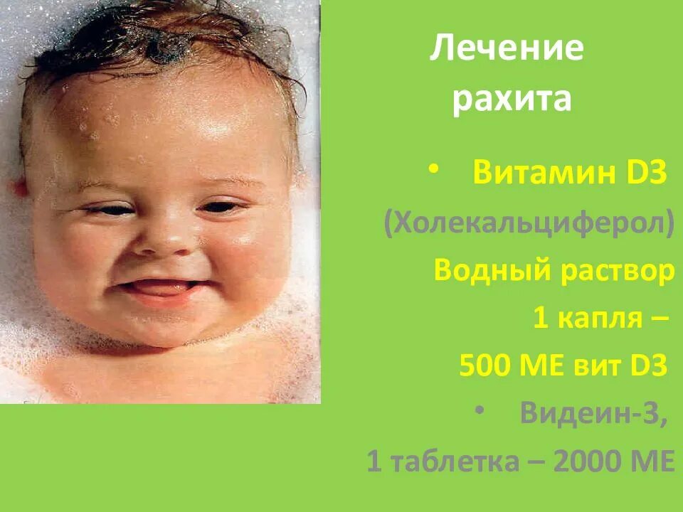 Рахит нехватка какого витамина. Рахит дефицит витамина д. витамин д дефицитный рахит у детей. рахит недостаток витамина д. недостаток витамина д рафит.