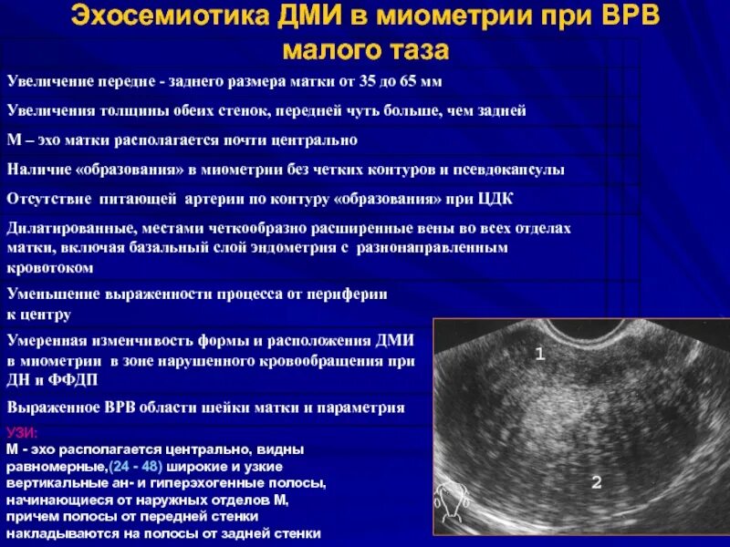 Диффузные изменения миометрия что это