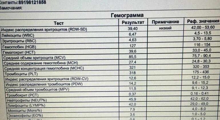 Относительная ширина распределения эритроцитов понижена. Показатели крови rdw-sd. rdw-sd в анализе норма. индекс распределения эритроцитов норма. норма rdw-sd в крови у женщин.
