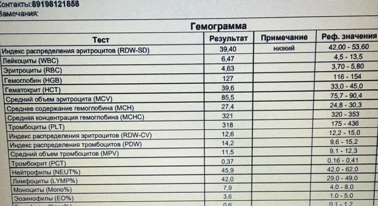 Показатели крови RDW-SD. RDW-SD В анализе норма. Индекс распределения эритроцитов норма. Показатель RDW-SD анализах в крови.