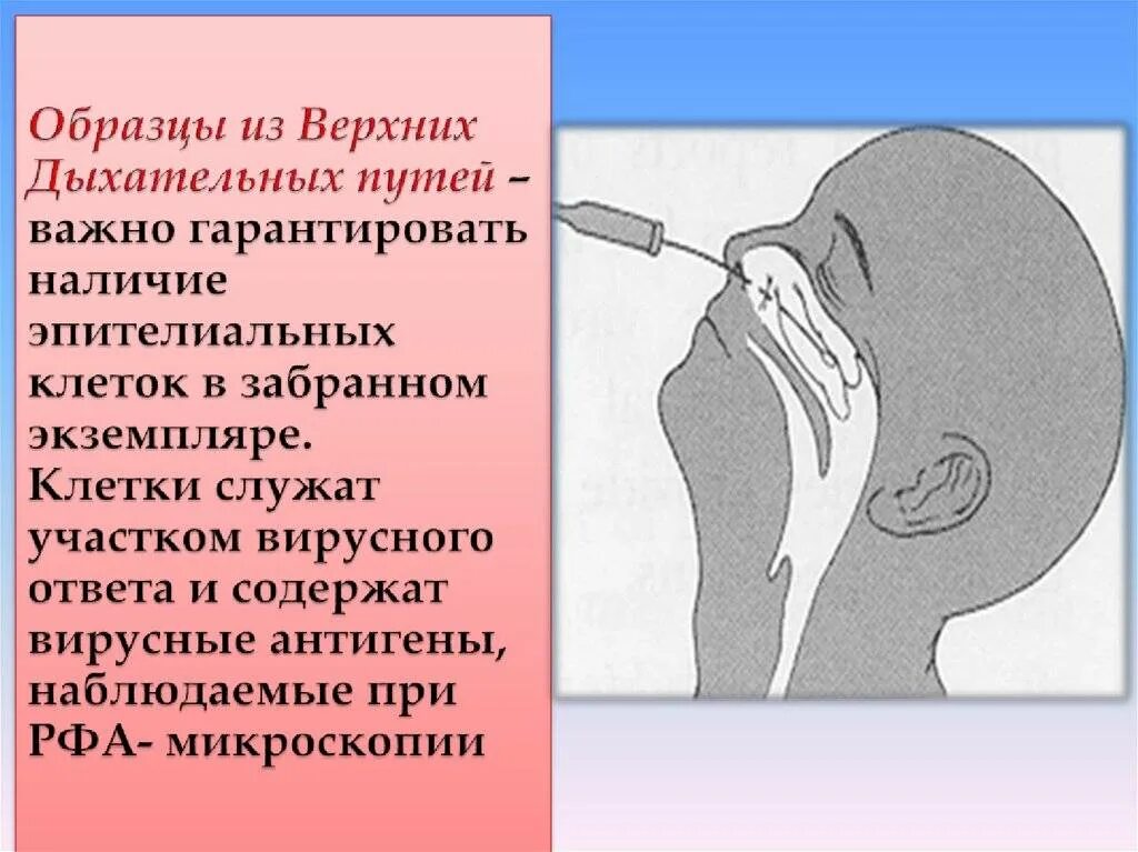 Способы выведения мокроты из дыхательных путей. Верхние дыхательные пути. Отсасывание содержимого из верхних дыхательных путей. Слизь в верхних дыхательных путях. Освобождение проходимости дыхательных путей.