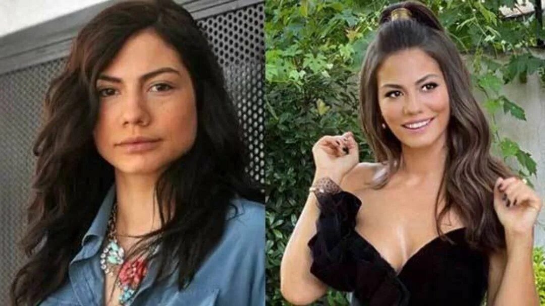 Демет до и после пластики. Демет оздемир пластика. Демет до и после пластики. Демет оздемир до пластики. Демет оздемир скулы.