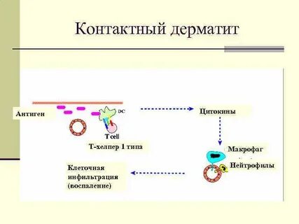 Аллергические дерматиты этиология