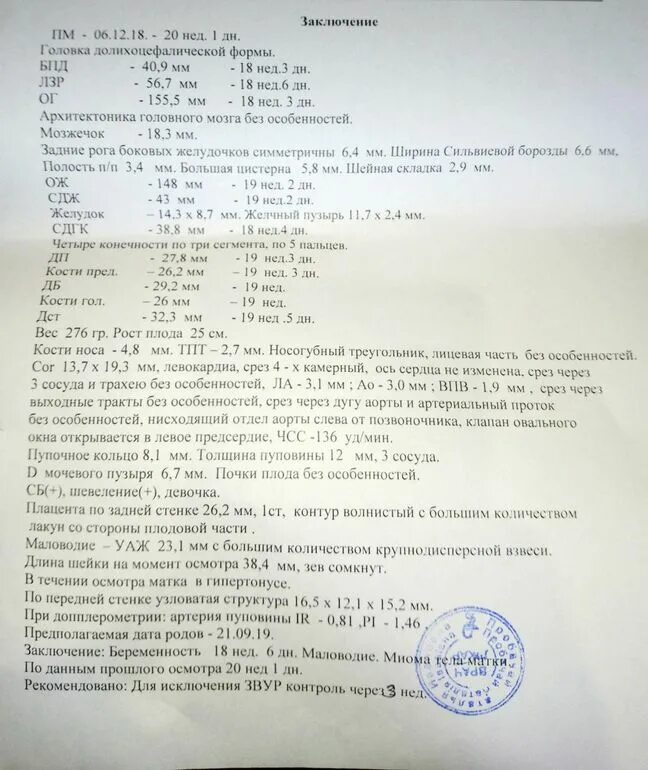 Маловодие 34 недели беременности по УЗИ норма. Маловодие при беременности 32 недели ИАЖ. Маловодие при беременности 20 недель УЗИ. ИАЖ норма по неделям. Маловодье 38 неделя