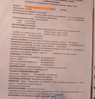 Узи головы самара