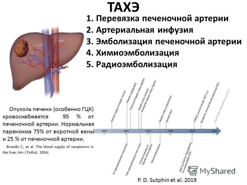 Трансартериальная химиоэмболизация опухоли печени. Химиоэмболизация печеночной артерии. Эмболизация печеночной артерии. Перевязка печеночной артерии. Удаление опухолей печени