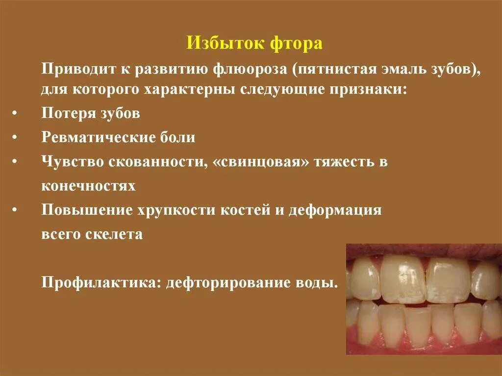 Почему зубы отличаются между собой. Системная гипоплазия эмали зубов. Системная гипоплазия эмали зубов у детей. Гипоплазия эмали гипоплазия флюороз.
