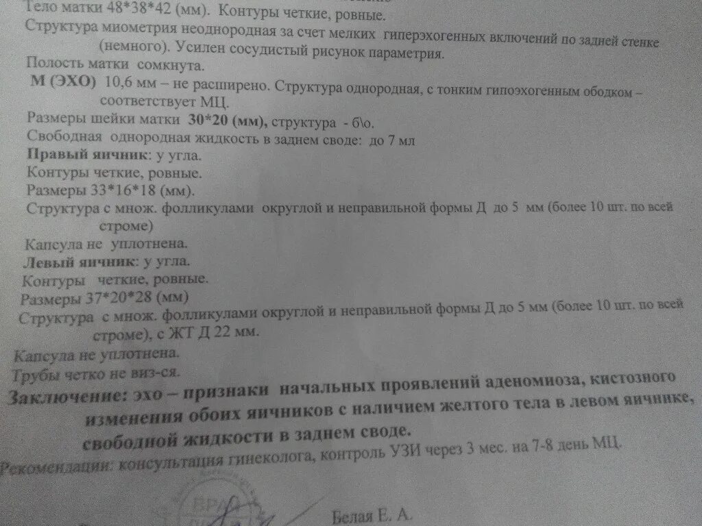 Диффузно очаговые изменения миометрия. Диффузно очаговые изменения миометрия