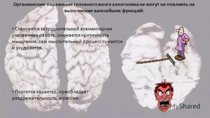 Диффузные органические поражения головного мозга. Органическое поражение мозга. органическое поражение мозга у ребенка. органическое поражение головного мозга симптомы. признаками органического поражения мозга являются.
