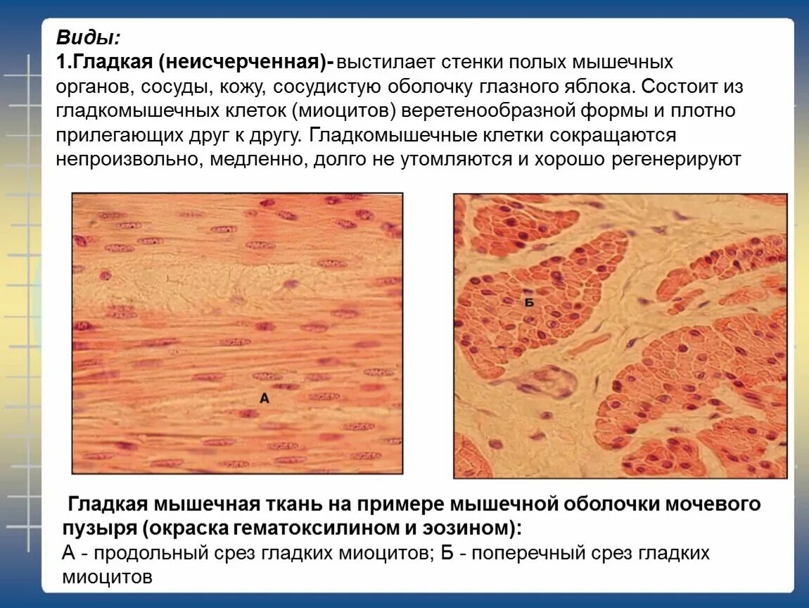 Состоят из многоядерных веретеновидных клеток. Гладкая мышечная ткань мочевого пузыря гистология. Гладкая мышечная ткань мочевого пузыря окраска гематоксилин эозин. Гладкая мышечная ткань. Окраска гематоксилином и эозином. Гладкая мышечная ткань гистология.