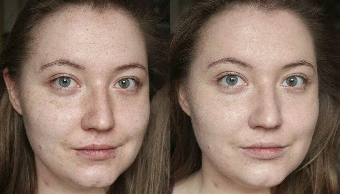 Цвет лица имел каленый. Тоналка BB Cream. Эффект ББ Глоу. ВВ Глоу эффект тонального крема.