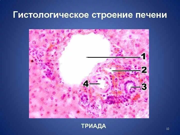 Междольковая артерия печени гистология. Междольковая триада печени гистология. Междольковая вена гистология. Междольковая вена гистология. Печеночная триада гистология препарат.