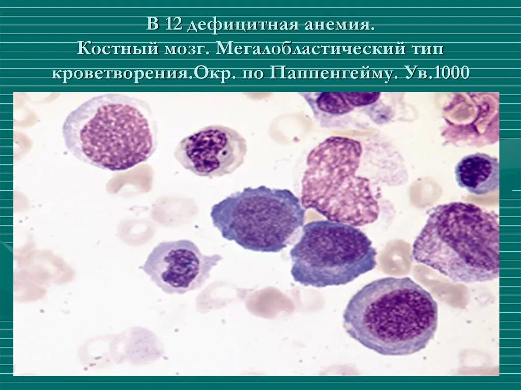 Эритробластический тип кроветворения схема. Нормобластическое кроветворение. Эритробластический нормобластический тип кроветворения. Эритропоэз нормобластического типа. Гемолитическая анемия анализ крови показатели.