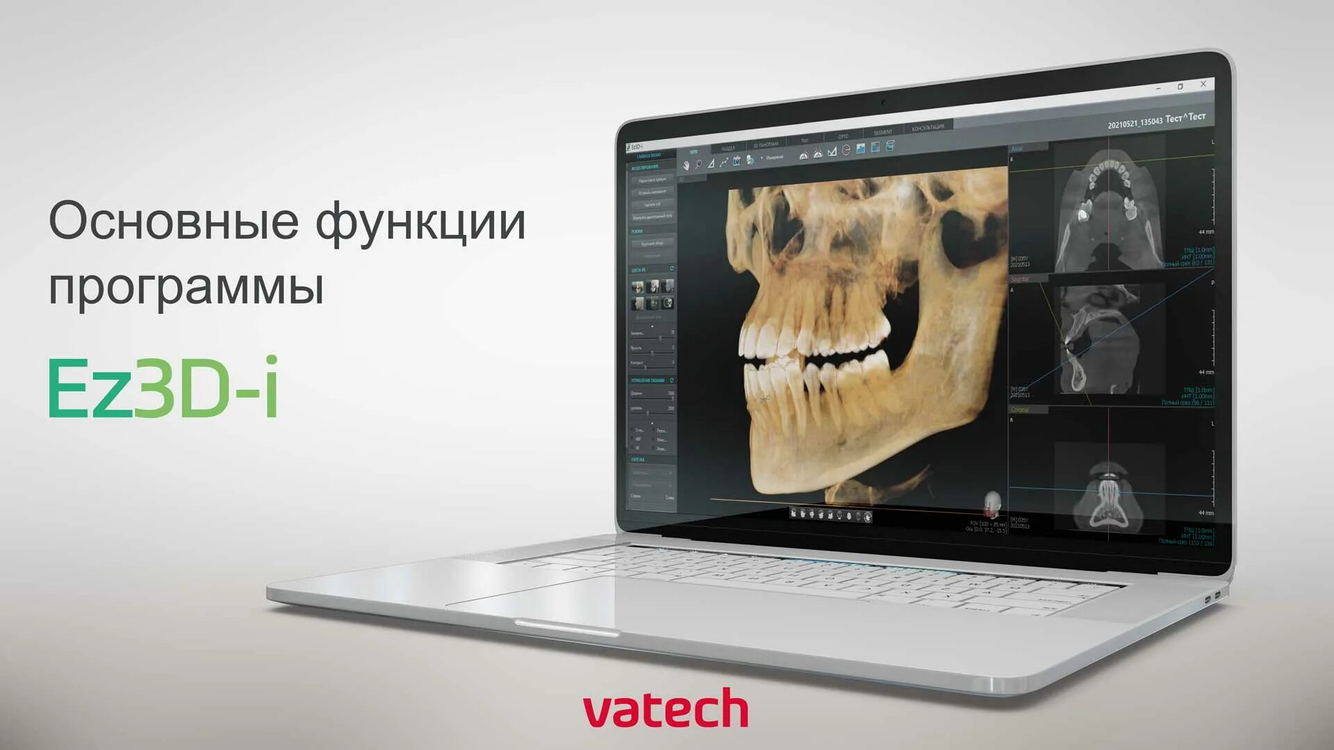 Ez3d-i. Томограф VATECH 3d. Ez3d Plus. VATECH кт. Ez3d2009