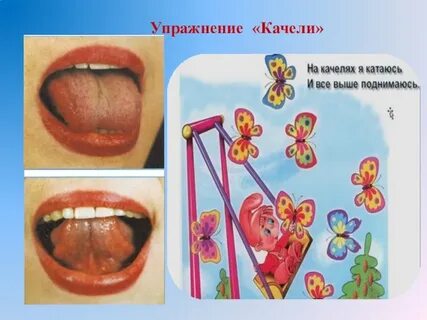 Артикуляционная гимнастика упражнение качели