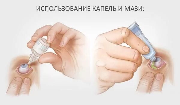 Как пользоваться каплями